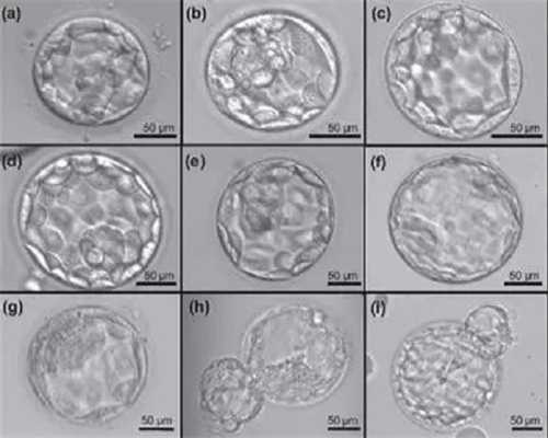 广州供卵需多少钱,广州最好的供卵医院