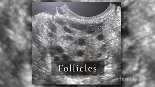 哺乳期怀孕了,怎样安全回奶?