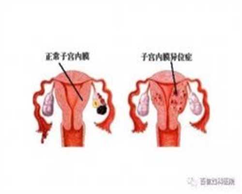 广州试管供卵选性别包男孩包成功